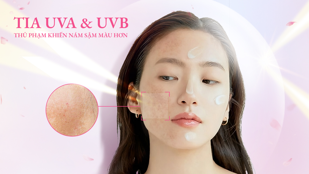 Vì Sao Kem Chống Nắng Lại Là Lá Chắn Bất Khả Xâm Phạm Với Da Nám
