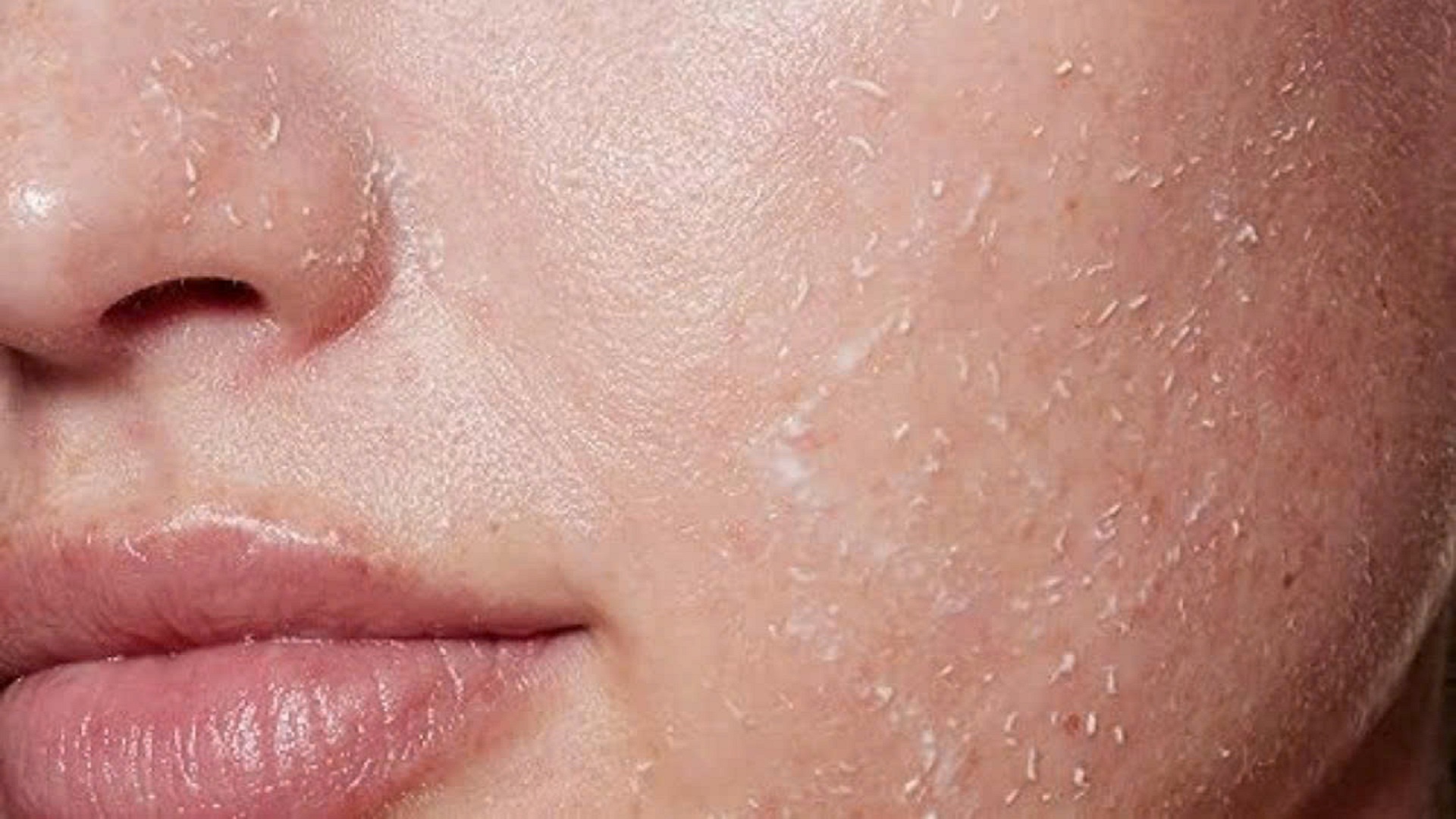 Vì sao da sau điều trị lại cần chống nắng kĩ hơn bình thường