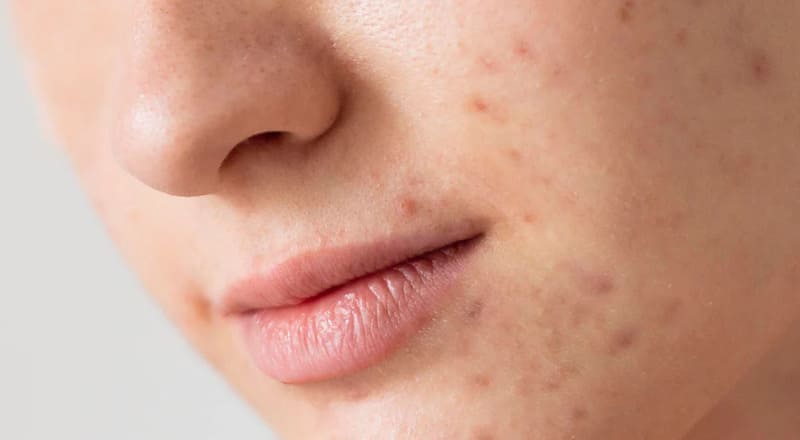 Cách chọn kem dưỡng ẩm phù hợp từng loại da