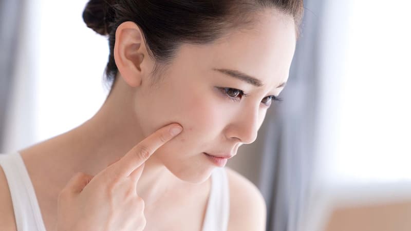 Tẩy trang giúp ngăn ngừa mụn