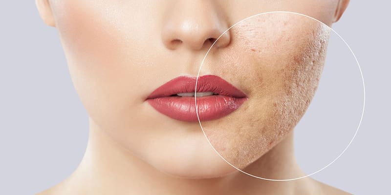 Các trường hợp nên dùng kem chống nắng SPF 50 trở lên