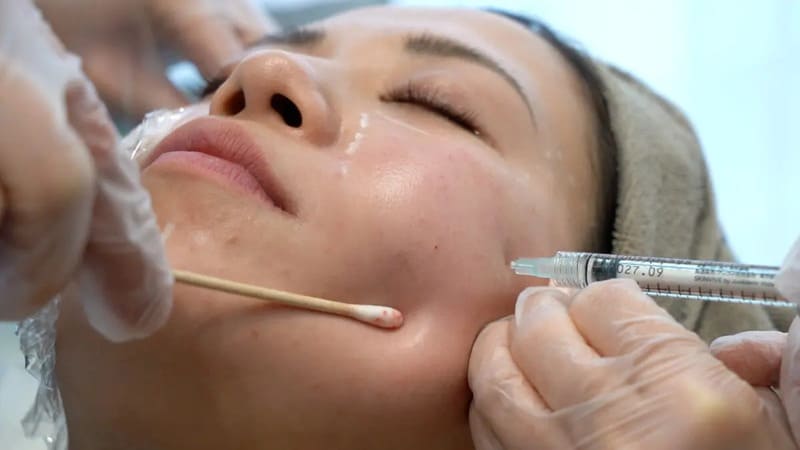 Da treatment là gì?