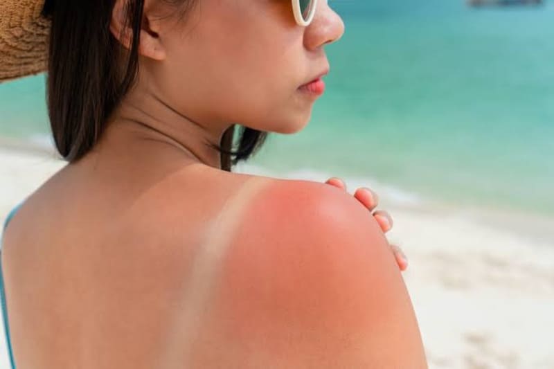Tác hại của tia UV đối với da