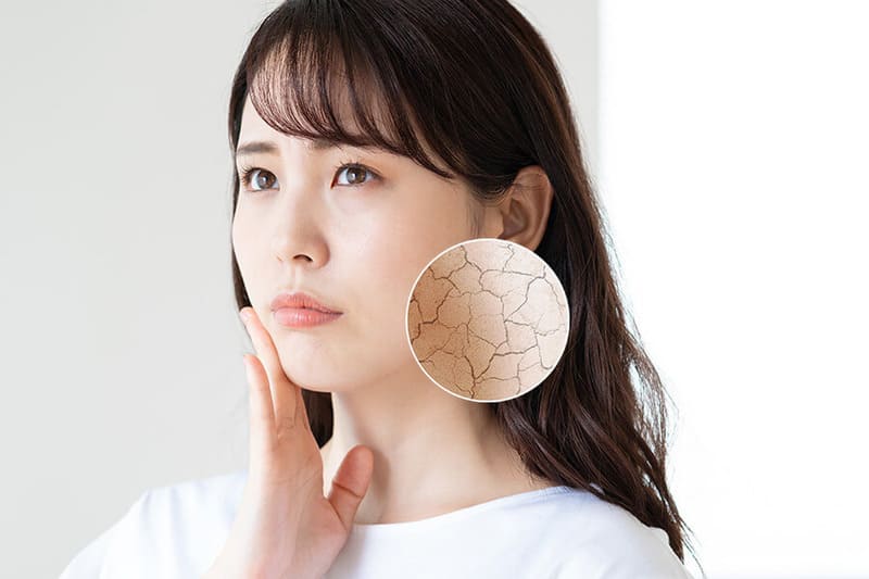 Mặt nạ có tác dụng cấp ẩm và làm mềm da